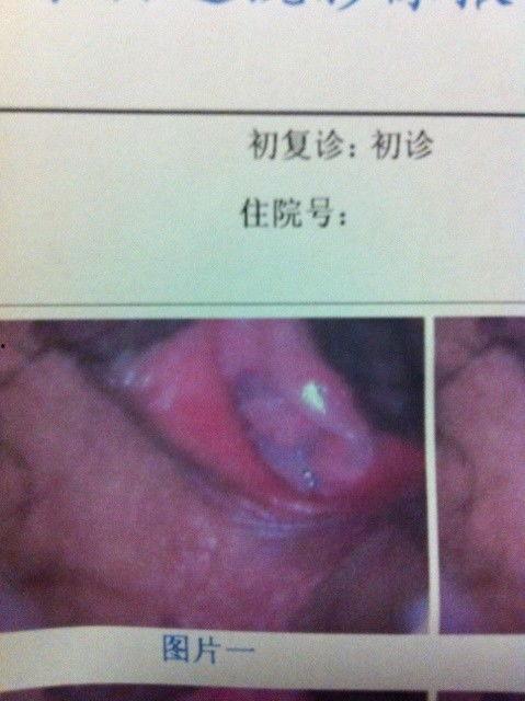 破处女膜视频,视频解析与科学解读