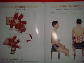 腰部拔罐视频,舒筋活络，体验传统中医养生之道