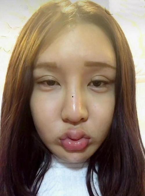 整容失败视频全集,惊心动魄的美丽代价