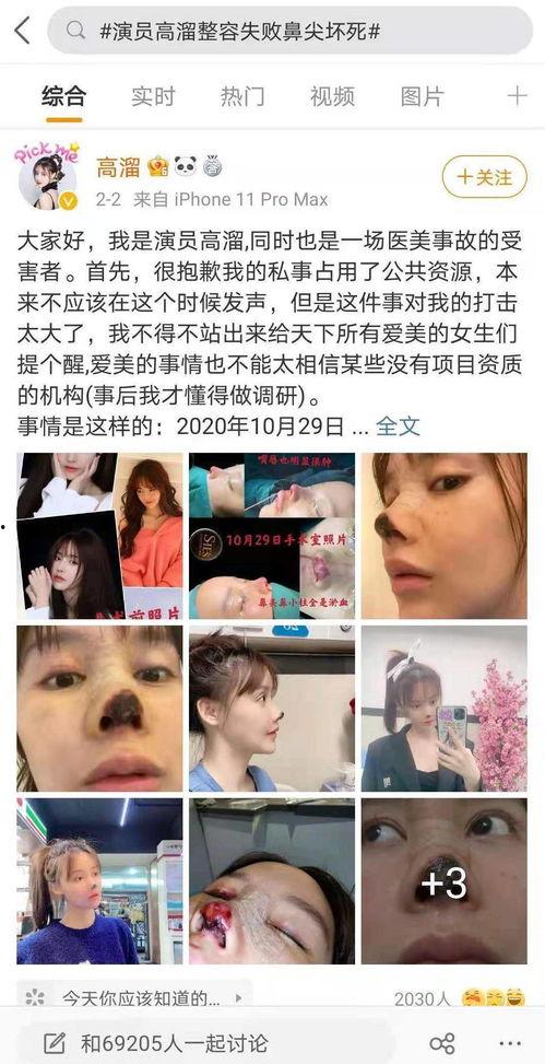 整容失败视频全集,惊心动魄的美丽代价