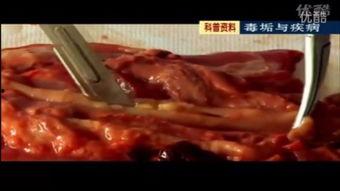 毒垢与健康视频,视频揭示健康与清洁生活的密钥