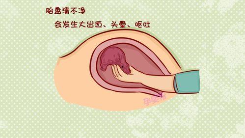 手剥胎盘视频,真实分娩瞬间
