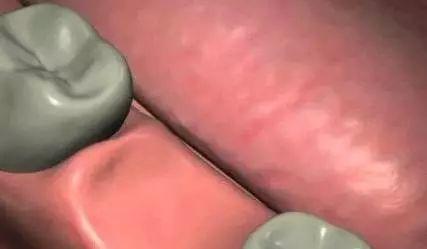 种牙全过程视频,从术前准备到术后恢复的全方位揭秘